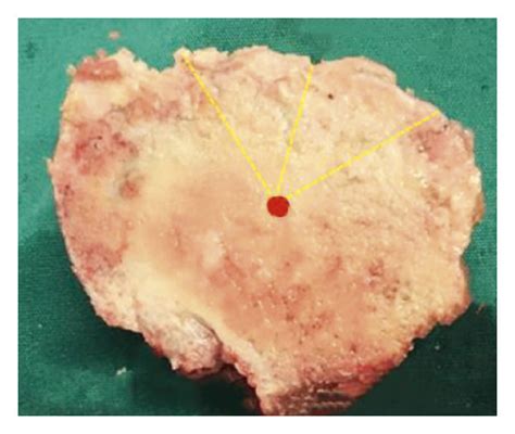 measurement schematic  ct group  ct   solid bone