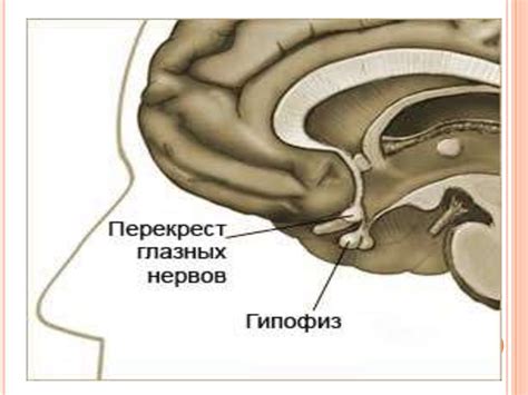 Синдром гиперкортицизма - презентация онлайн