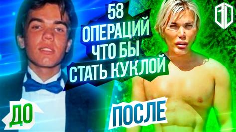 58 ОПЕРАЦИЙ, что бы стать КУКЛОЙ с СИЛИКОНОВЫМИ мышцами / Родриго Алвес ...