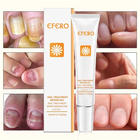 Aliexpress.com : Buy 2PCS Nail Repair Essence Nails Cuticle Remover ...