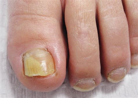 Advanced Technology | Montgomery County Foot and Ankle Treatment