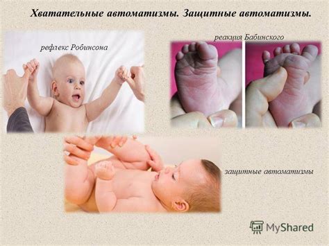 Рефлексы новорожденного: Моро, реакции Бабинского, Бабкина, Галанта ...