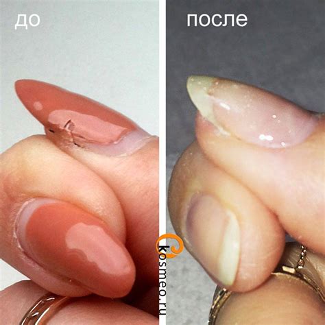 Сломался ноготь. Что делать, как починить под гель-лаком, шеллаком ...