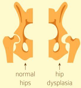 Hip-Dysplasia-Infants-Image.jpg.2 - Babies carrier
