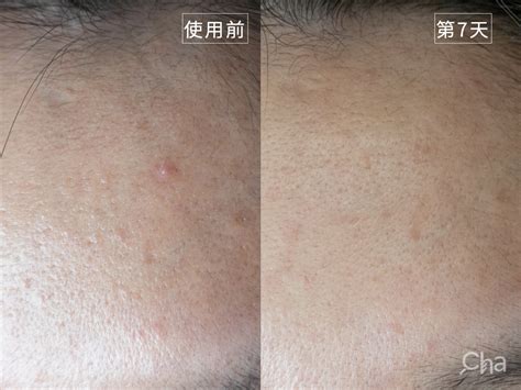 A酸2 – 找Cha研究室