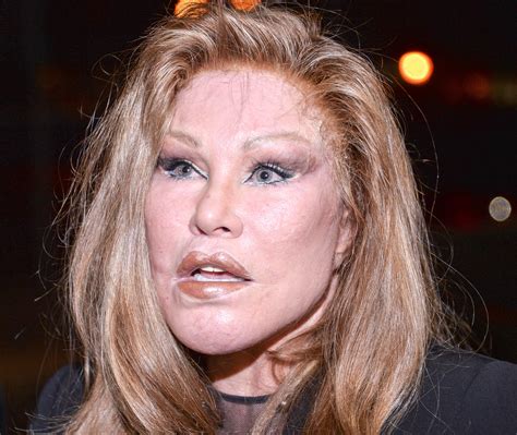 Billionaire 'Catwoman' Jocelyn Wildenstein Claims She Never Had Any
