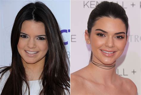 Kendall Before And After