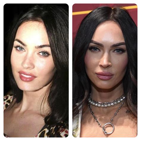 Megan Fox Nose Jobs Before And After