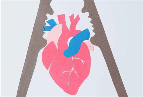 What Is Vasospasm? - Klarity Health Library