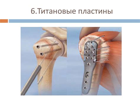 Социология тела - здоровье, болезнь и старение - online presentation