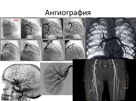 Основы кардиоваскулярной хирургии - презентация онлайн