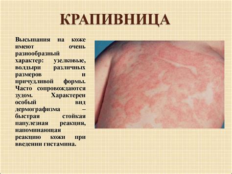 Семиотика поражений кожи и подкожно- жировой клетчатки - презентация онлайн