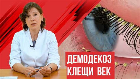 Лечение демодекса и его симптомы. Фото и причины появления болезни