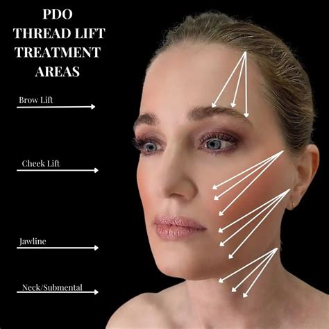 pdo threads spectrum dermatology  seattle