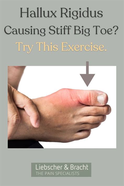 hallux rigidus causing stiff big toe     painful big