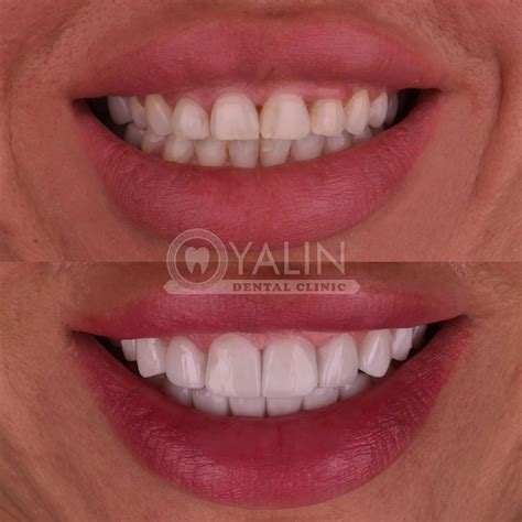 Witness The Change: Faydwynn Morningstar's Unbelievable Before & After