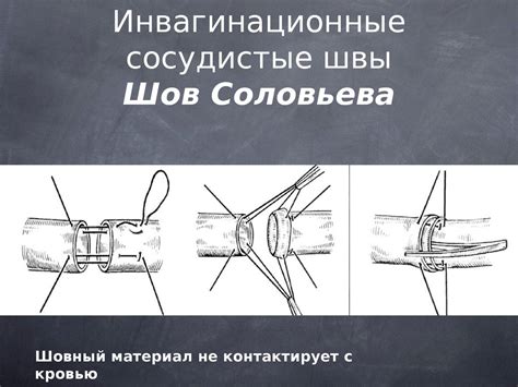 Основы сосудистой хирургии. Сосудистый шов - презентация онлайн