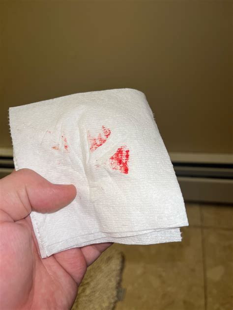 Blood when I wipe after drinking alcohol : r/shittingadvice