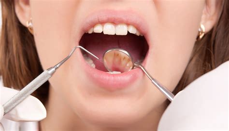 Avoiding Antibiotic Tooth Stains - Placerville Dental Group