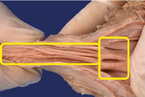 Figure 1 from Morphology of the female reproductive organs of the ...