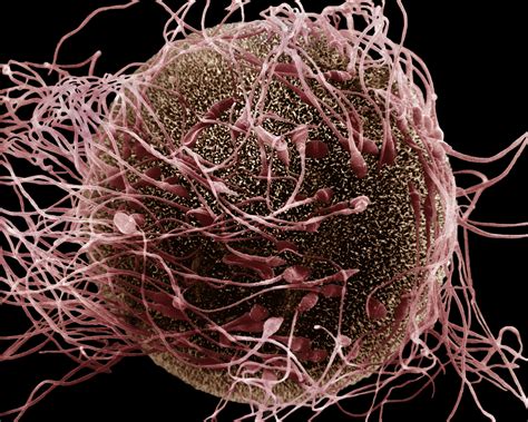 If A Diploid Sperm Fertilized A Diploid Egg 5