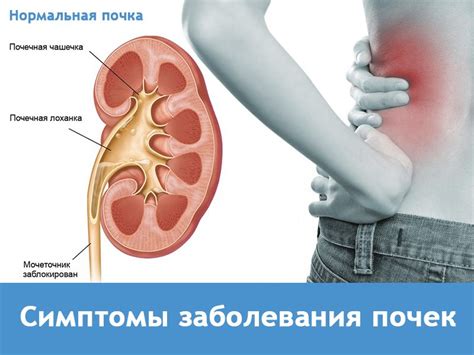 Признаки заболеваний почек - Новости Владивостока и Приморья (16+)