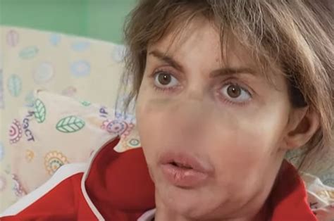 Кого Алиса Казьмина винит в своей болезни