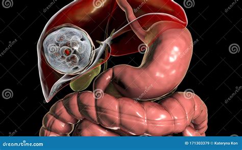 An Echinococcus Granulosus Stock Illustration | CartoonDealer.com #134032276