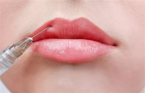 Револакс дип и его цена | Kosmetologiya-dermatologiya.az