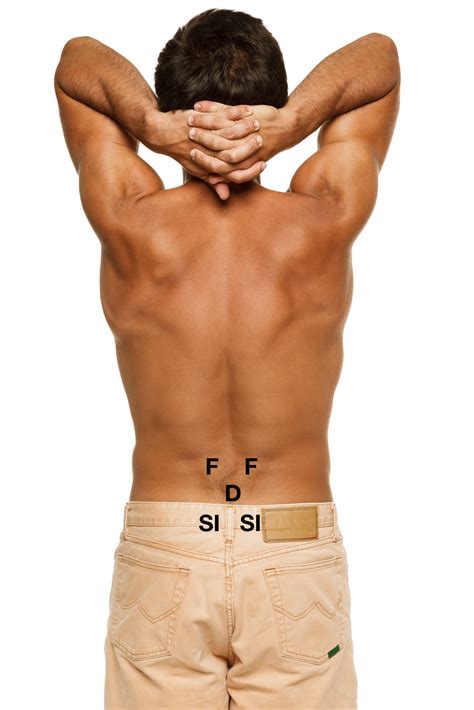 COMMON SOURCES OF LOW BACK PAIN - Dr. Martin Schmaltz