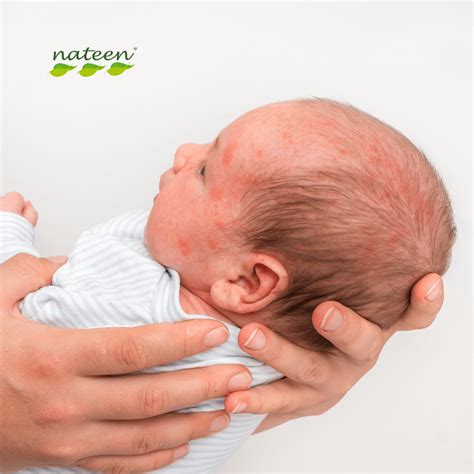 What Does Hypoallergenic Mean And How Does It Help Your Sensitive Skin ...