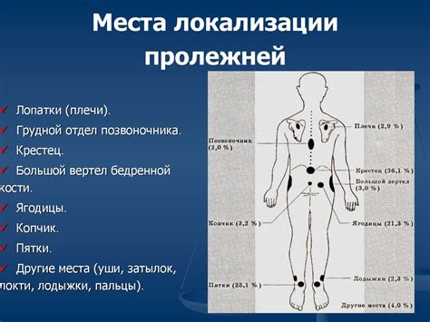 Инсульт. Статистика инсульта - презентация онлайн