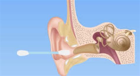 how to clean your ears without cotton buds
