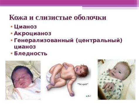«Семиотика и диагностика заболеваний сердечно-сосудистой системы» Доцент