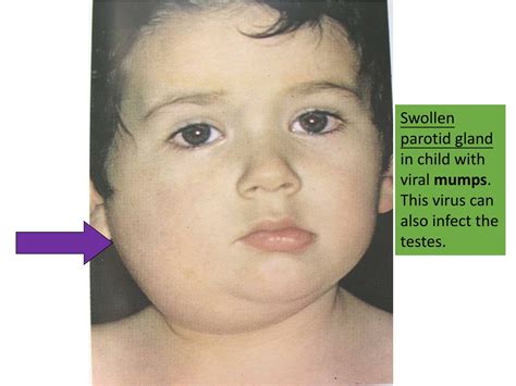 alimentary canal powerpoint    id