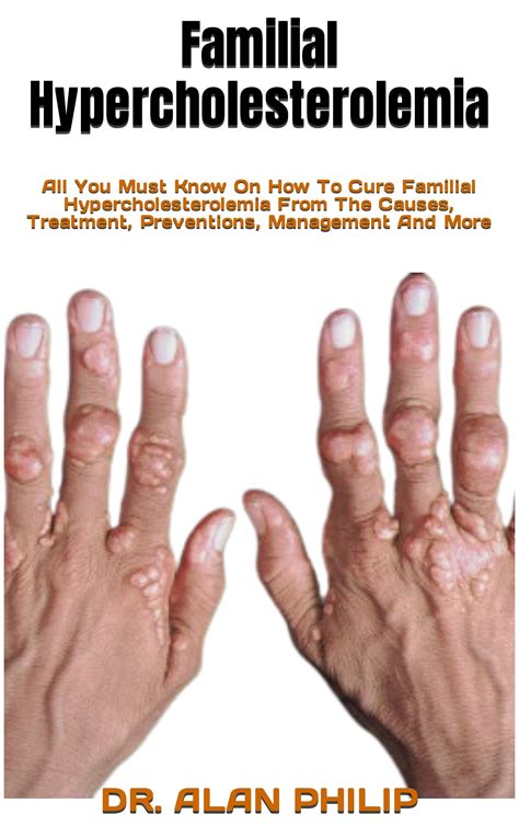 Familial Hypercholesterolemia : All You Must Know On How To Cure ...
