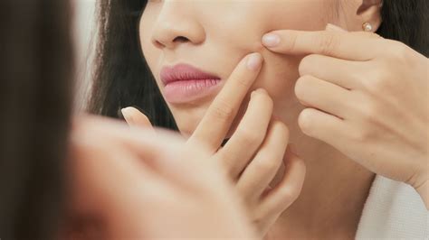 The Unbelievable Blackhead Removal 2024 Secret Dermatologists Don't Want You To Know! Image 11