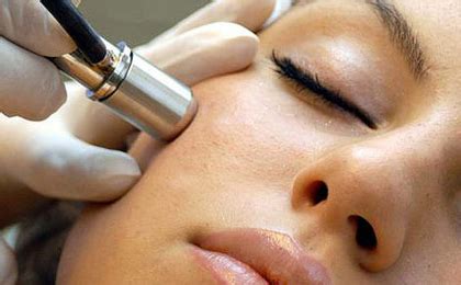 Will laser skin treatment make me look younger?