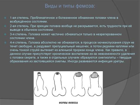 Фимоз. Парафимоз. Баланопостит - презентация онлайн