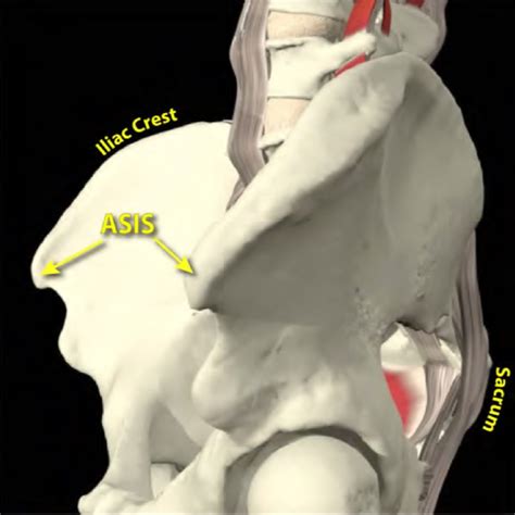 Level Pelvis Method - North Oakland Chiropractic Clinic