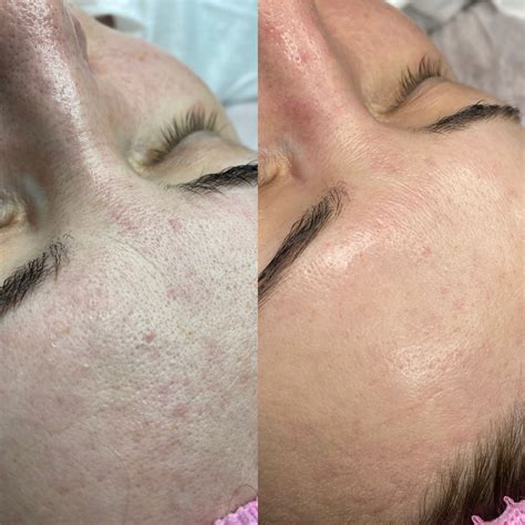 Pin de Aizara em Inst | Estética facial, Estética, Imagens de limpeza
