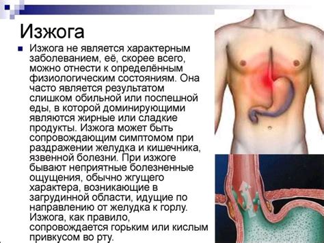 Почему может вырвать от Изжоги? | Ответы Mail