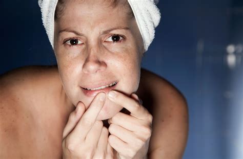 What Dermatologists REALLY Think About Unbelievable Blackhead Removal 2024! Image 7