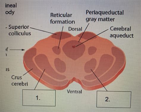 Solved ineal ody Reticular formation Dorsal Periaqueductal | Chegg.com