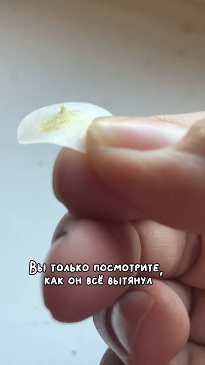 Патчи от прыщей с микроиглами, артикул в инст: jamilya_nazarova - YouTube