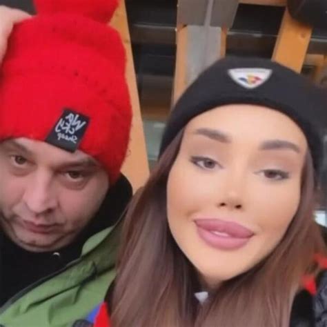 Ana Korać na Kopaoniku posle razvoda