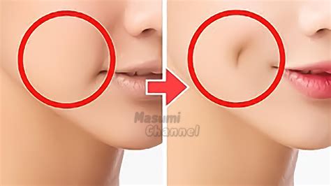 5mins Dimples Exercise! Simple Facial Exercises To Get Dimples with Pen ...