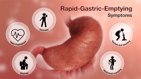 Gastric
