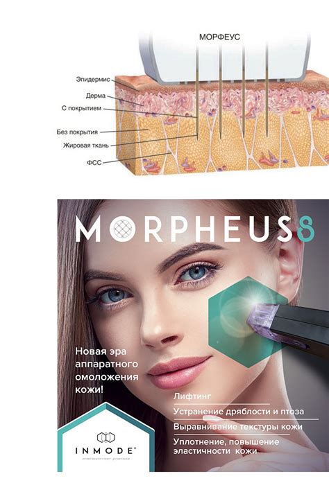 Микроигольчатый RF-лифтинг Morpheus 8. Процедура игольчатый РФ-лифтинг ...