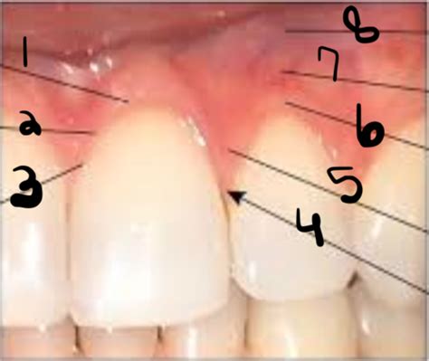 gingival description Flashcards | Quizlet